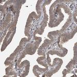 LLGL1 Antibody in Immunohistochemistry (Paraffin) (IHC (P))