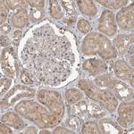 LLGL1 Antibody in Immunohistochemistry (Paraffin) (IHC (P))