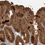 LLGL1 Antibody in Immunohistochemistry (Paraffin) (IHC (P))