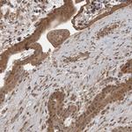 LLGL1 Antibody in Immunohistochemistry (IHC)