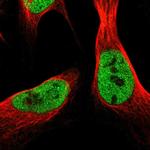 SCRN2 Antibody in Immunocytochemistry (ICC/IF)