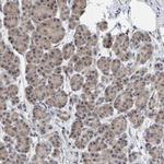 SCRN2 Antibody in Immunohistochemistry (IHC)