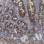 NMT1 Antibody in Immunohistochemistry (Paraffin) (IHC (P))