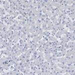 NMT1 Antibody in Immunohistochemistry (Paraffin) (IHC (P))