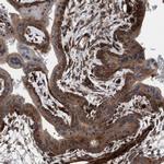 NMT1 Antibody in Immunohistochemistry (IHC)