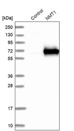 NMT1 Antibody in Western Blot (WB)