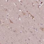 RIPX Antibody in Immunohistochemistry (IHC)