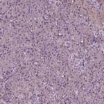 RIPX Antibody in Immunohistochemistry (IHC)