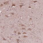 RIPX Antibody in Immunohistochemistry (IHC)