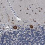 NMT1 Antibody in Immunohistochemistry (IHC)