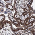 NMT1 Antibody in Immunohistochemistry (IHC)