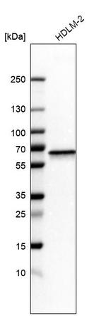 NMT1 Antibody in Western Blot (WB)