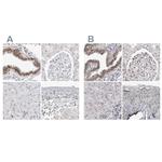 WRAP53 Antibody in Immunohistochemistry (IHC)