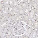 WRAP53 Antibody in Immunohistochemistry (IHC)