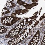 MRPL12 Antibody in Immunohistochemistry (Paraffin) (IHC (P))