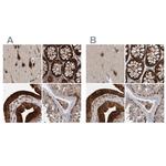 KIAA0753 Antibody in Immunohistochemistry (IHC)