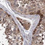 KIAA0753 Antibody in Immunohistochemistry (IHC)