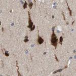 KIAA0753 Antibody in Immunohistochemistry (IHC)