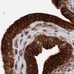 KIAA0753 Antibody in Immunohistochemistry (IHC)