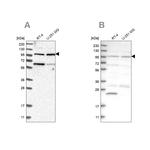 KIAA0753 Antibody in Western Blot (WB)