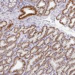 ZNF526 Antibody in Immunohistochemistry (Paraffin) (IHC (P))