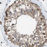 SLC38A10 Antibody in Immunohistochemistry (IHC)