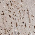 WWP1 Antibody in Immunohistochemistry (Paraffin) (IHC (P))