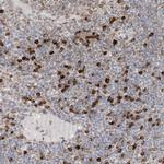 WWP1 Antibody in Immunohistochemistry (Paraffin) (IHC (P))