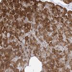 WWP1 Antibody in Immunohistochemistry (Paraffin) (IHC (P))