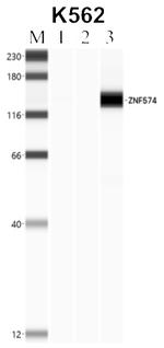 ZNF574 Antibody in RNA Immunoprecipitation (RIP)