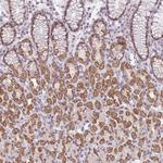 ZNF574 Antibody in Immunohistochemistry (Paraffin) (IHC (P))