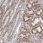 POLG2 Antibody in Immunohistochemistry (IHC)