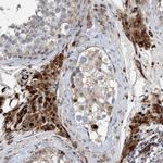 POLG2 Antibody in Immunohistochemistry (IHC)