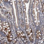 POLG2 Antibody in Immunohistochemistry (IHC)