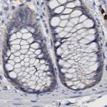 PNPO Antibody in Immunohistochemistry (IHC)