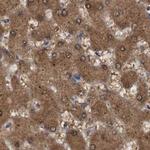 PNPO Antibody in Immunohistochemistry (IHC)