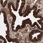 VBP1 Antibody in Immunohistochemistry (Paraffin) (IHC (P))