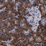 Arylsulfatase G Antibody in Immunohistochemistry (IHC)