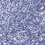 Arylsulfatase G Antibody in Immunohistochemistry (IHC)