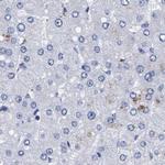 Arylsulfatase G Antibody in Immunohistochemistry (IHC)