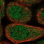 NPLOC4 Antibody in Immunocytochemistry (ICC/IF)