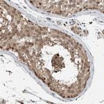 NPLOC4 Antibody in Immunohistochemistry (IHC)