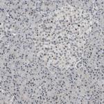 NPLOC4 Antibody in Immunohistochemistry (IHC)