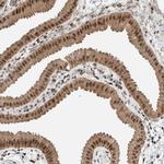 NPLOC4 Antibody in Immunohistochemistry (IHC)