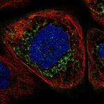 ALDH7A1 Antibody in Immunocytochemistry (ICC/IF)