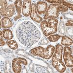 ALDH7A1 Antibody in Immunohistochemistry (IHC)