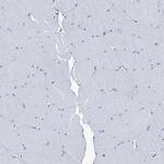 Septin-7 Antibody in Immunohistochemistry (IHC)