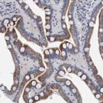 SLC28A3 Antibody in Immunohistochemistry (Paraffin) (IHC (P))