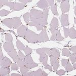 SHMT1 Antibody in Immunohistochemistry (Paraffin) (IHC (P))