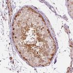 SHMT1 Antibody in Immunohistochemistry (Paraffin) (IHC (P))